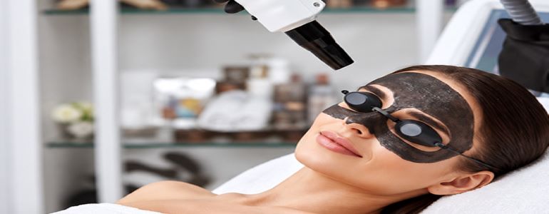 Carbon peeling - Hollywood peeling hibrid workshop